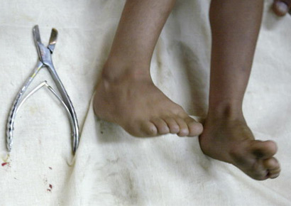 Iraqi Children Circumcised in Baghdad