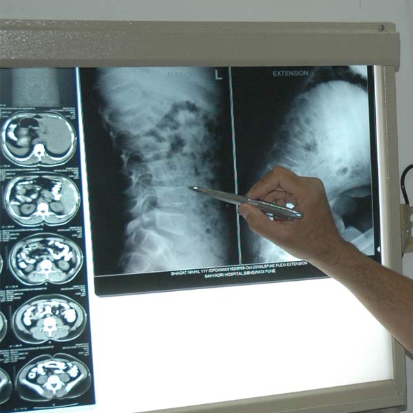 XRays and their harmful effects Latest News & Updates at Daily News