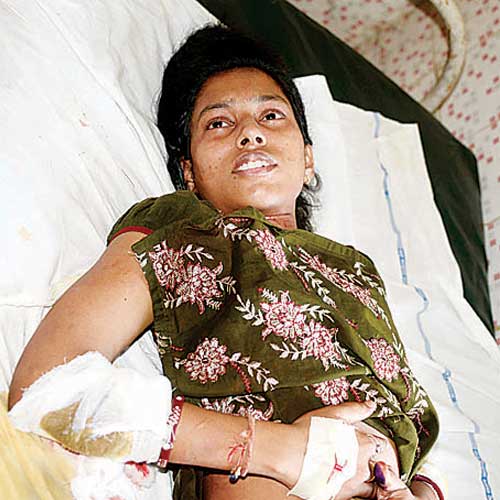 Durga, 22, is battling for her life at a Virar hospital