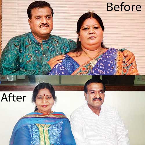 Surat-based couple Bharat and Pinakini Parikh before and after the bariatric surgey.