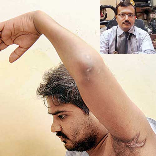 Pokharkar shows his injuries; (inset) Dr Praful Lokhande.