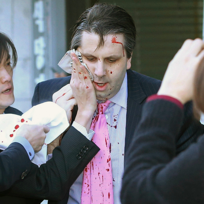 Knife-wielding attacker slashes face of US ambassador in South.