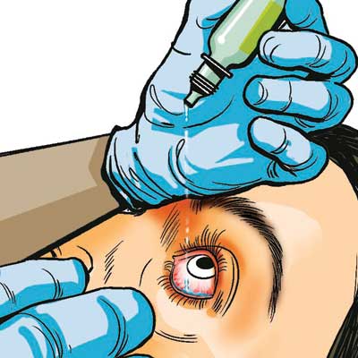 Seven suspended after 37 develop eye infection at MP eye camp