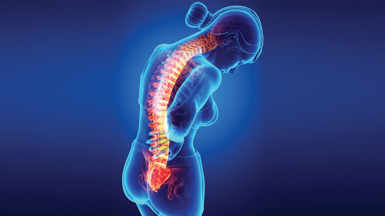 flipboard-spinal-disorders-a-back-breaking-concern