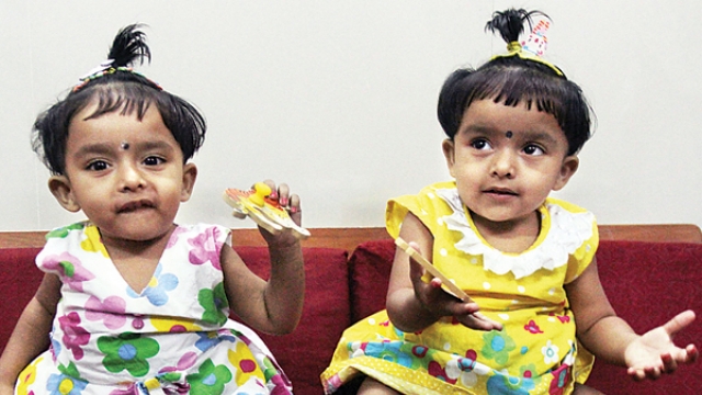 Image result for conjoined twins ridhi sidhi