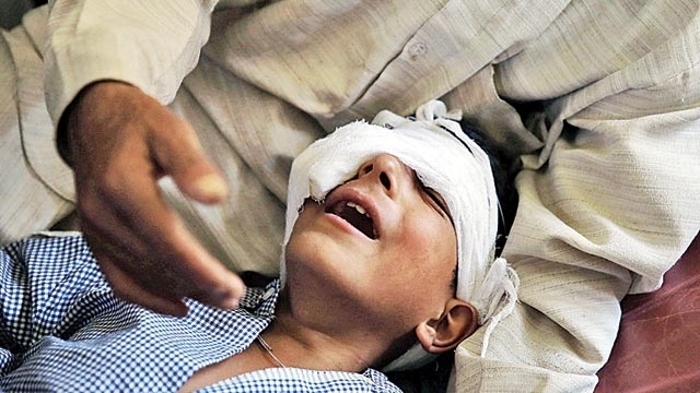 Jammu and Kashmir: To save eyes, pellet guns get deflectors