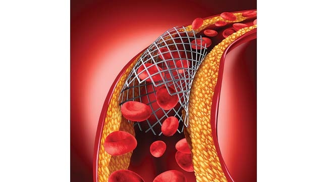 Another global firm seeks to withdraw its stents Another global firm seeks to withdraw its stents