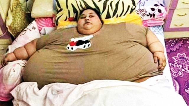 Doc junks claim of Eman's sister questioning her weight loss