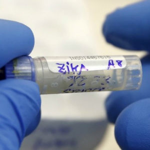 Two Vietnamese women contract Zika virus, first in Vietnam Two Vietnamese women contract Zika virus, first in Vietnam